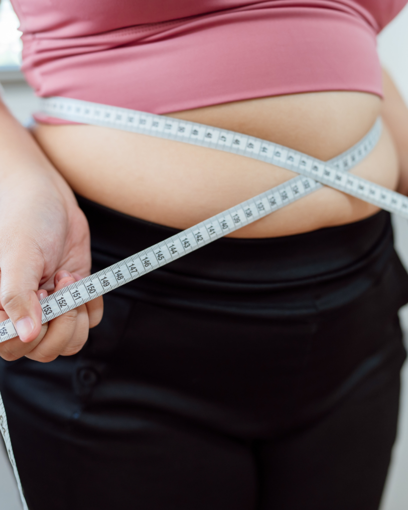 σύνδρομο Pickwick obese woman