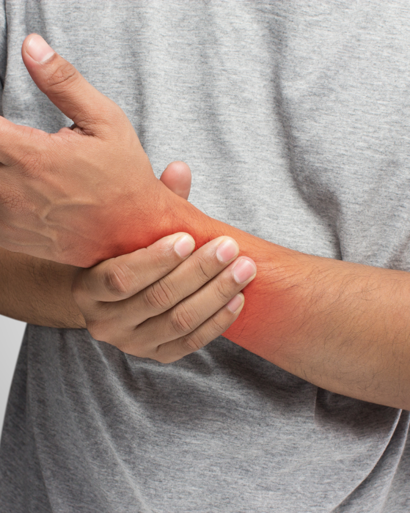 κάταγμα Colles man in wrist fracture