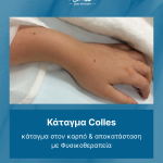 11κάταγμα Colles cover