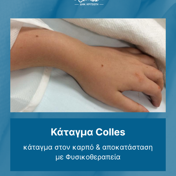 κάταγμα Colles cover