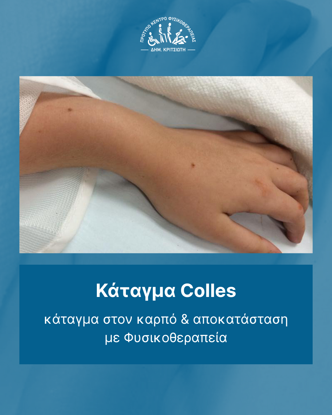 κάταγμα Colles cover