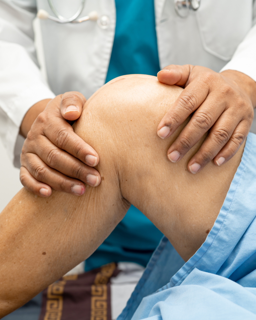ρήξη μηνίσκου knee physiotherapy
