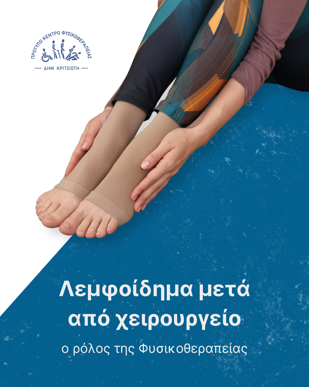 λεμφοίδημα cover